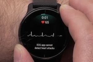 Приложение Garmin ЭКГ теперь доступно для большего количества часов фото